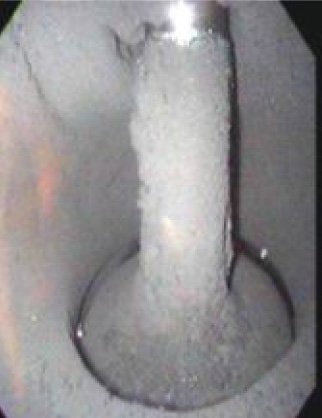 エンジンの調子気になりませんか？